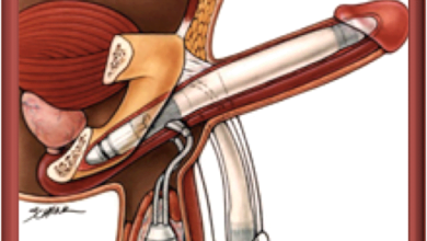 Marco Antonio Quesada Ribeiro Fortes