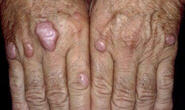 Marco Antonio Quesada Ribeiro Fortes