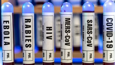 Marco Antonio Quesada Ribeiro Fortes